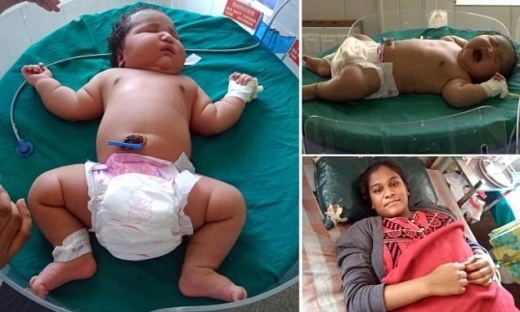 세계서 가장 큰 녀아 인도서 탄생… 체중 6.8키로그람